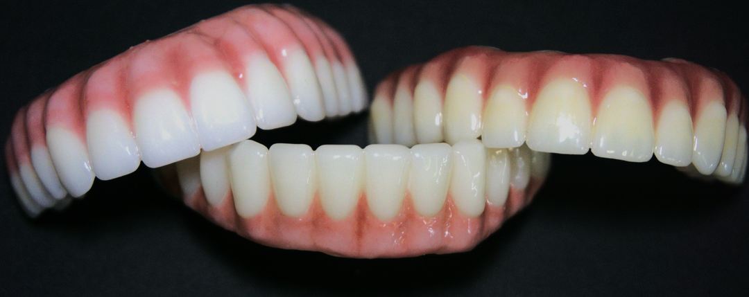 How to create a beautiful and realistic gingiva on a zirconia denture using CGI Gum Stains