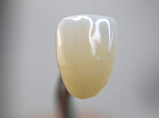 How to Characterize a single zirconia crown using CGI stain pastes