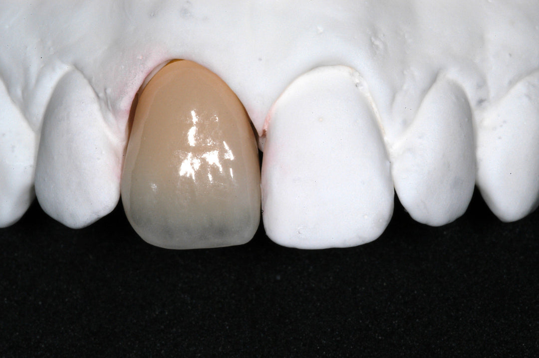Understanding CrystalCeram® Porcelain System